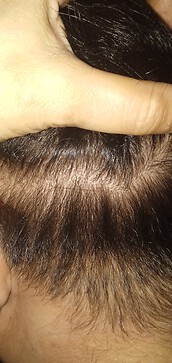 Part of my scalp and you can see there is irritation after a routine bath 