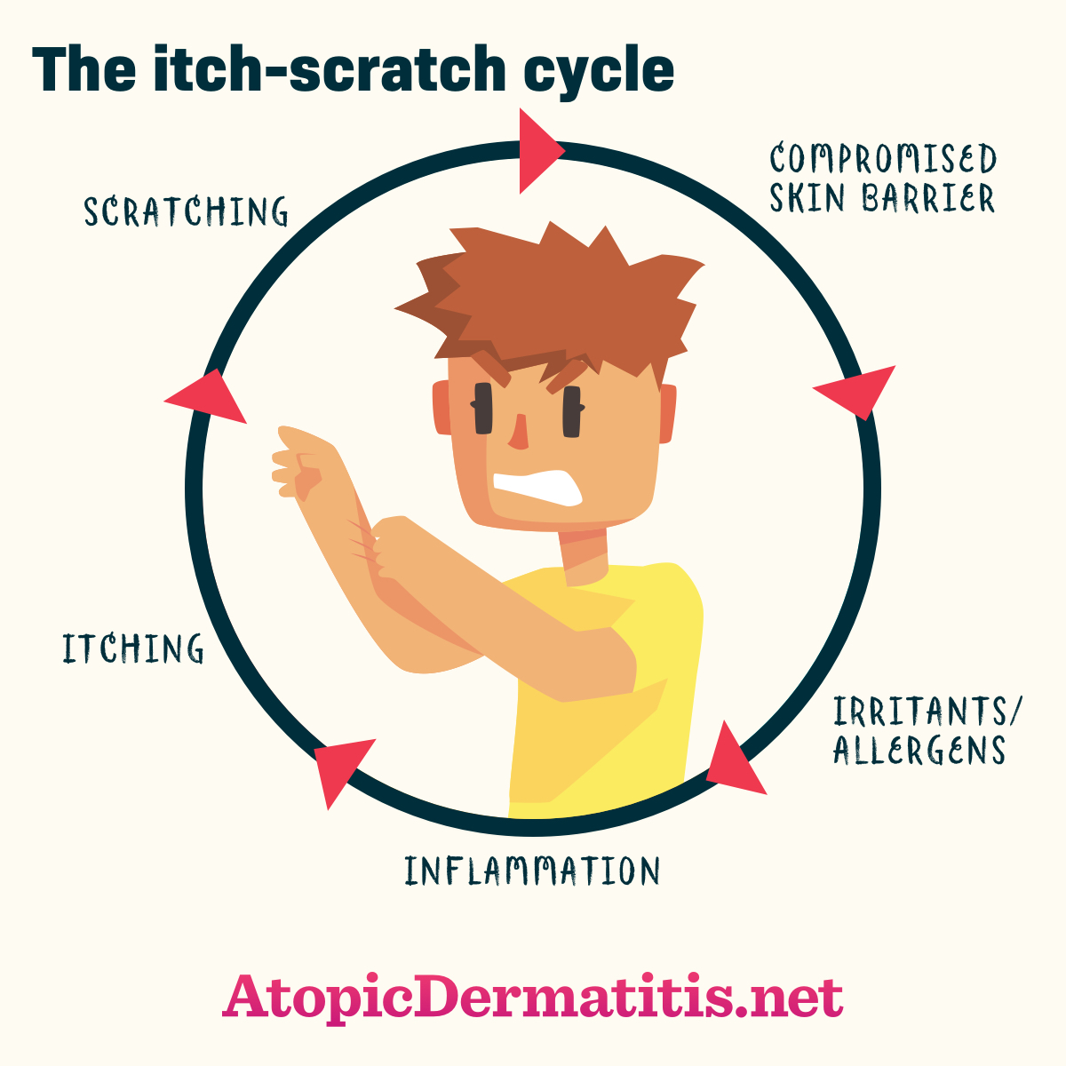 Itch-Scratch Cycle