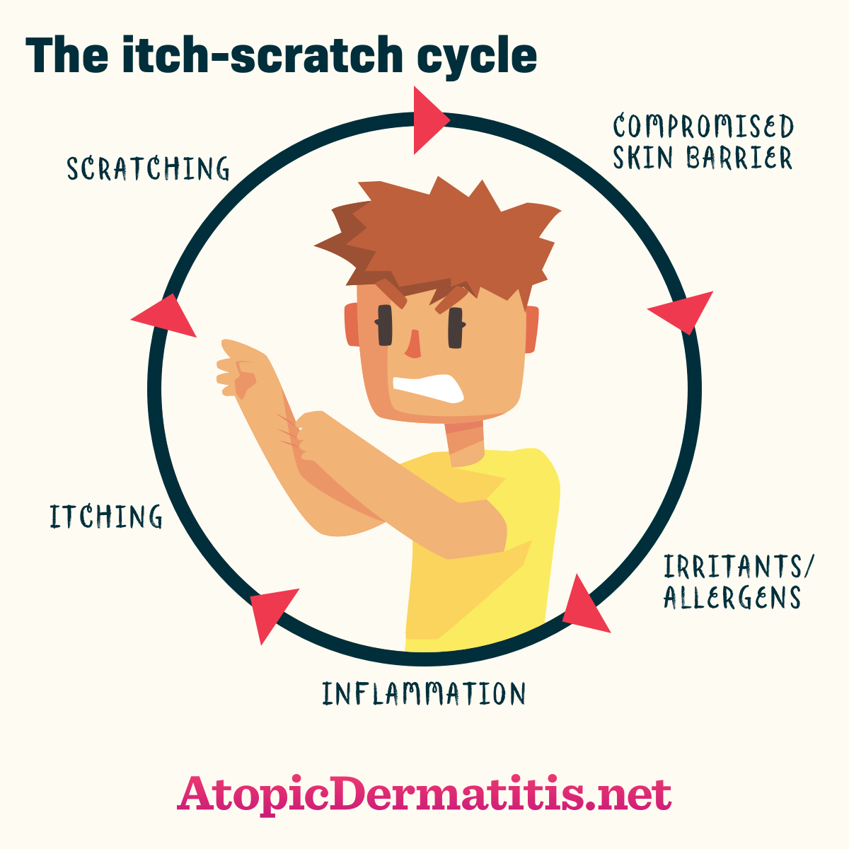 What Is The Itch Scratch Cycle Atopicdermatitis Net