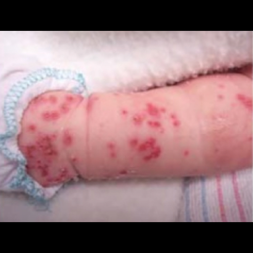 Red bumps on baby's arm