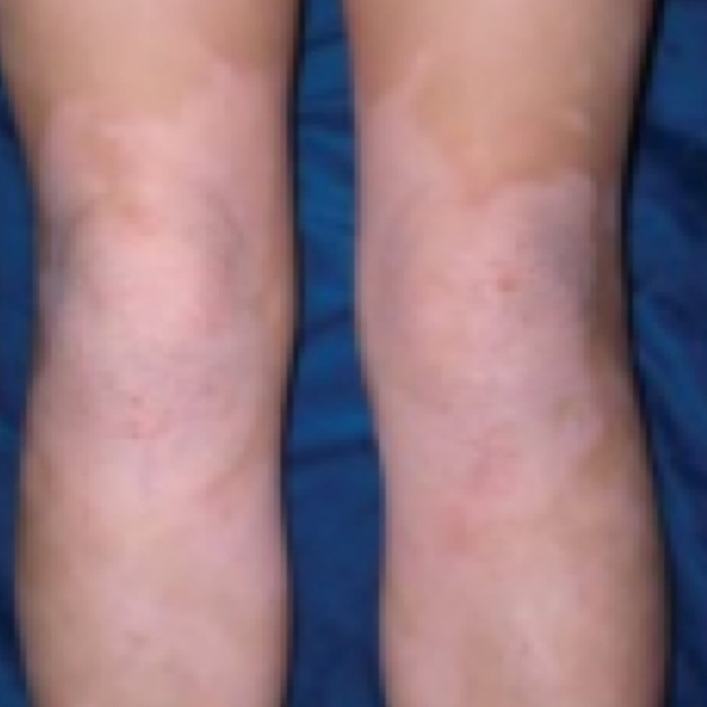Changes in Skin Color