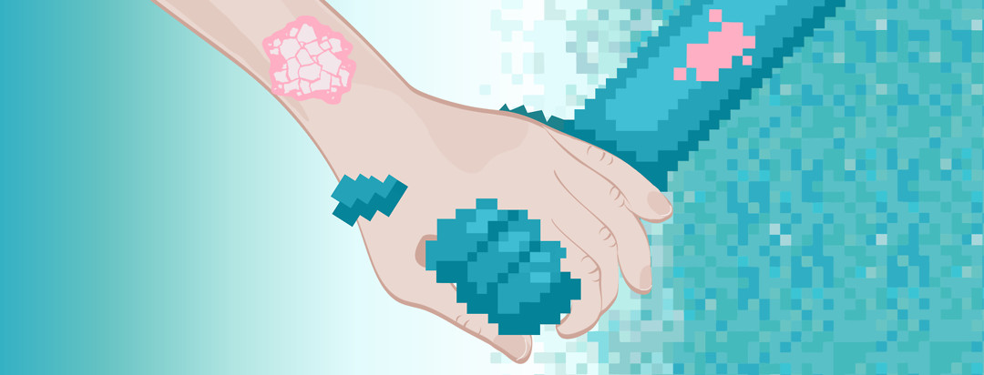 A realistic hand is reaching out and clasping a pixelated hand. Both wrists show atopic dermatitis.