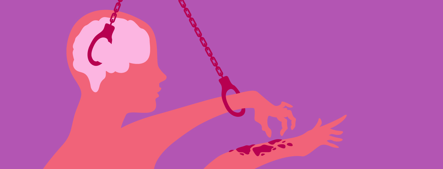 A figure is preparing to itch eczema on their arm, but a chain is handcuffed from their brain to the itching hand, keeping it from doing so.