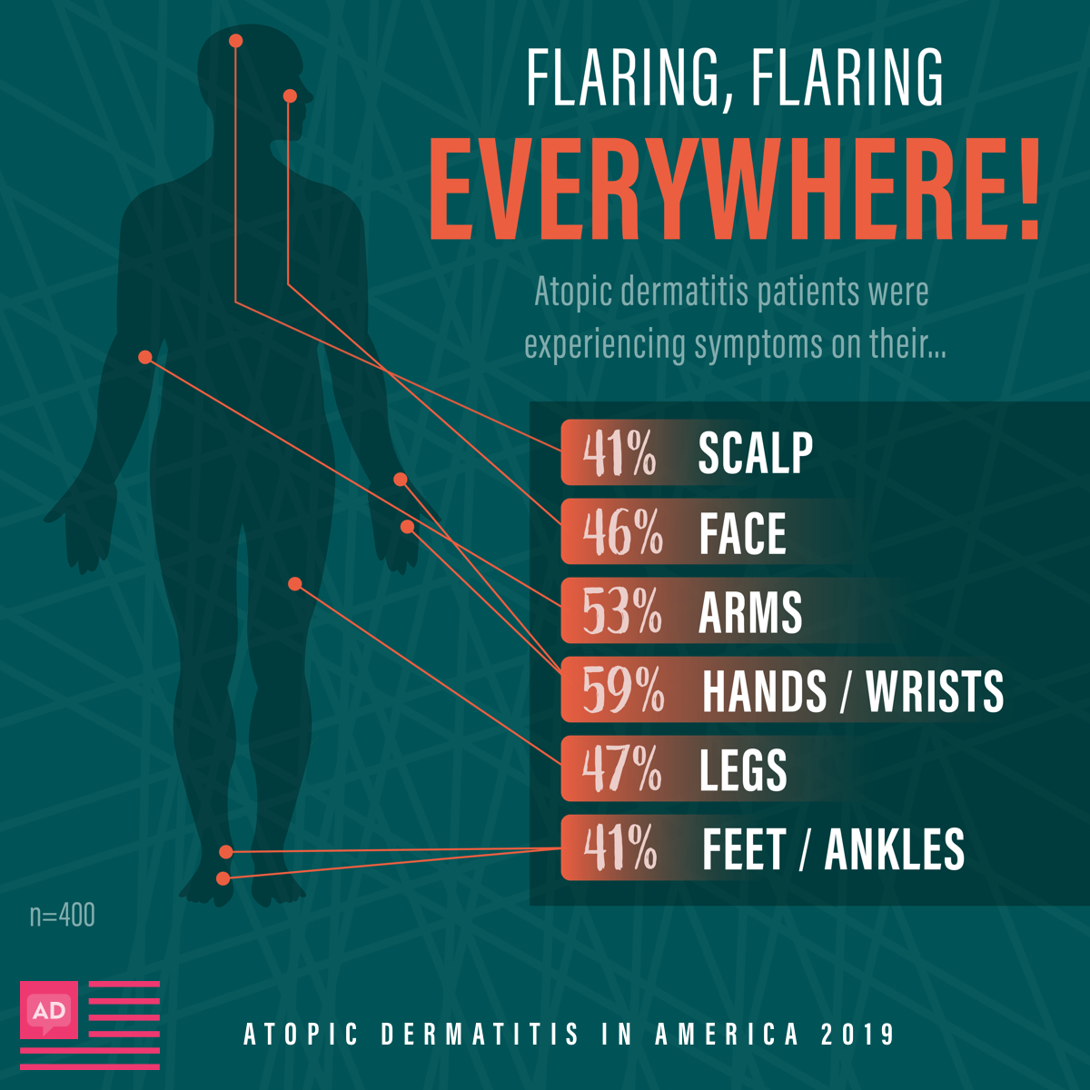 Atopic dermatitis patients experienced flares mostly on their hands and wrists, arms, legs, face, feet and ankles, and scalp.