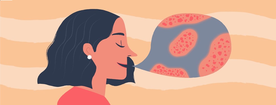 a woman speaking and her speech bubble has eczema on it