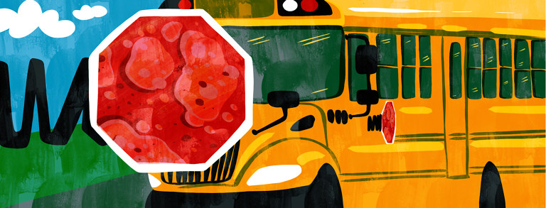 A school bus with a red stop sign extended showing eczema patches all over it.