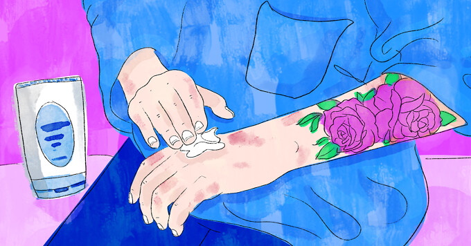 Eczema and Tattoos: The Healing Process image