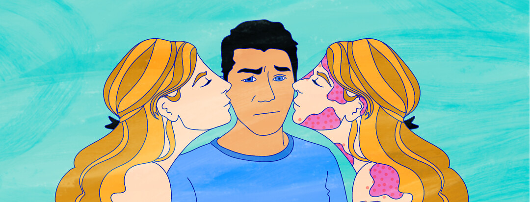 A man stands between two versions of the same woman kissing each of his cheeks. One version has clear skin, the other has eczema.