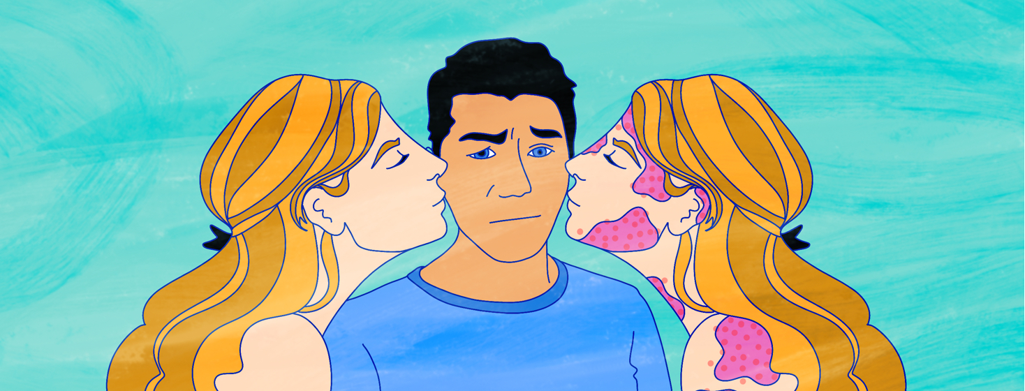 A man stands between two versions of the same woman kissing each of his cheeks. One version has clear skin, the other has eczema.