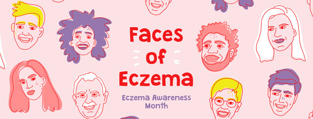 Share a Photo for Eczema Awareness Month image