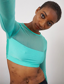 Atopic dermatitis advocate Raelle sporting a buzzed haircut and a bright crop top shirt, showing eczema on her abdomen.