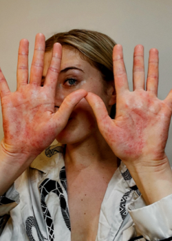 A woman holding up her hands to the camera