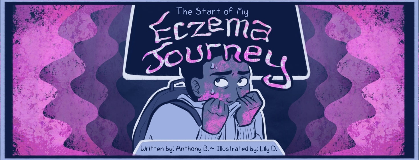 A comic for a CCR called "The Start of My Eczema Journey" That depicts a story from an advocate on their first major eczema flare up in high school and how that affected their life afterwards.