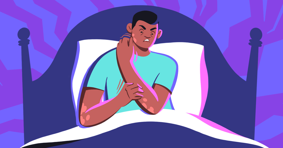 The Midnight Itch image